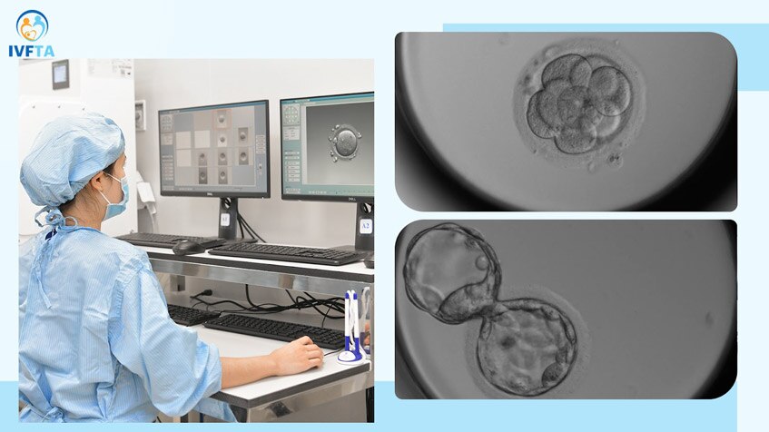 Chuyên viên phôi học quan sát quá trình phôi phân chia Chuyên viên phôi học quan sát quá trình phôi phân chia