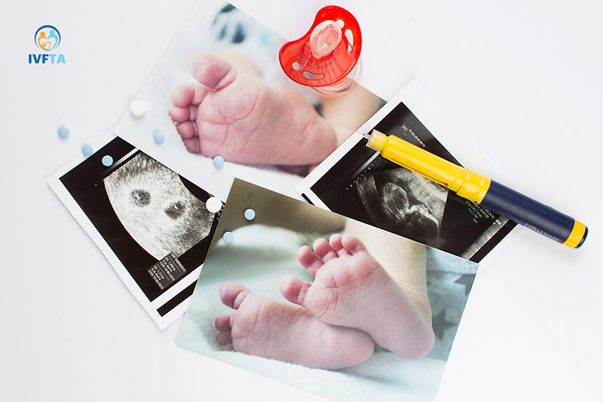 Tiêm kích trứng là bước quan trọng trong điều trị hỗ trợ sinh sản