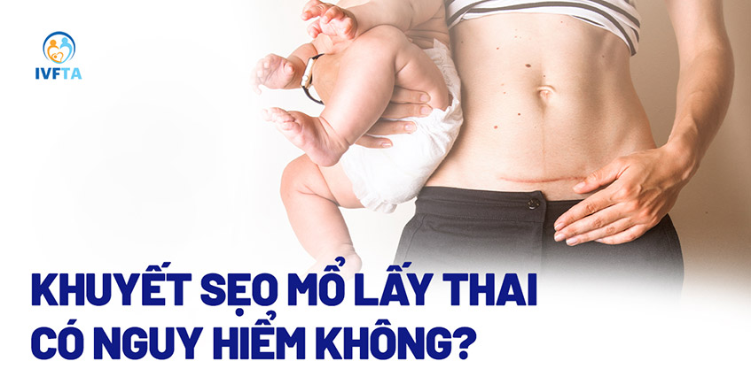 Khuyết sẹo mổ lấy thai có nguy hiểm không