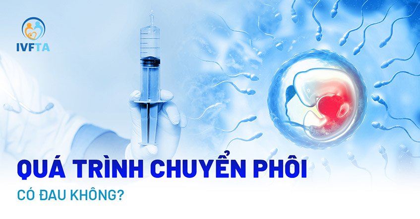 Chuyển phôi có đau không?