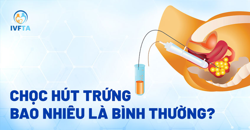 Chọc hút trứng bao nhiêu là bình thường Chọc hút trứng bao nhiêu là bình thường