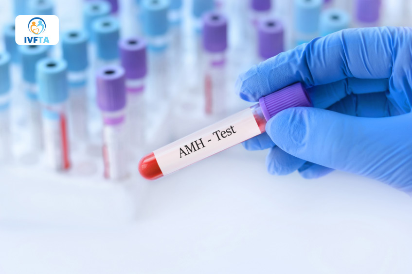 Chỉ số AMH cung cấp thông tin về dự trữ buồng trứng của người phụ nữ Chỉ số AMH cung cấp thông tin về dự trữ buồng trứng của người phụ nữ