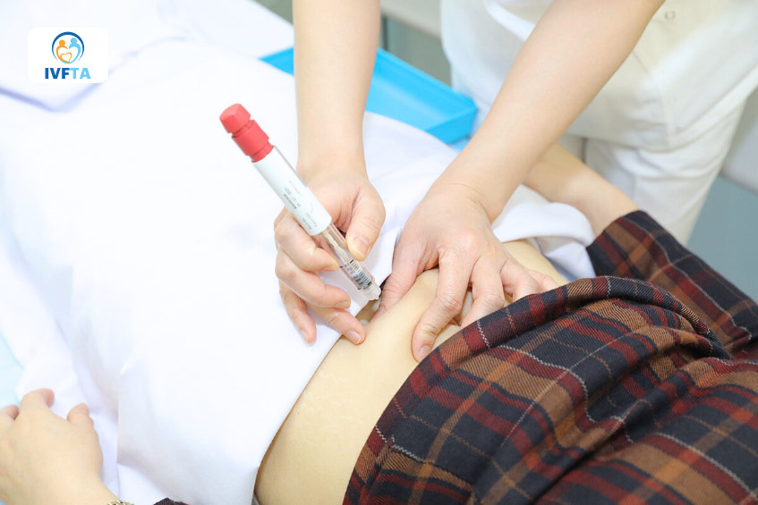 Kích thích buồng trứng là bước quan trọng khi điều trị hiếm muộn với trường hợp AMH thấp Kích thích buồng trứng là bước quan trọng khi điều trị hiếm muộn với trường hợp AMH thấp