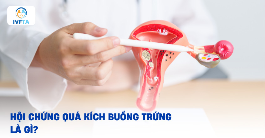 Quá kích buồng trứng là gì? Quá kích buồng trứng là gì?