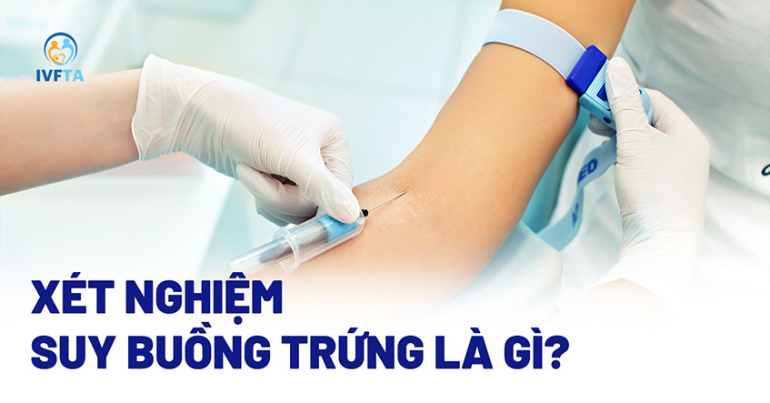 Xét nghiệm suy buồng trứng