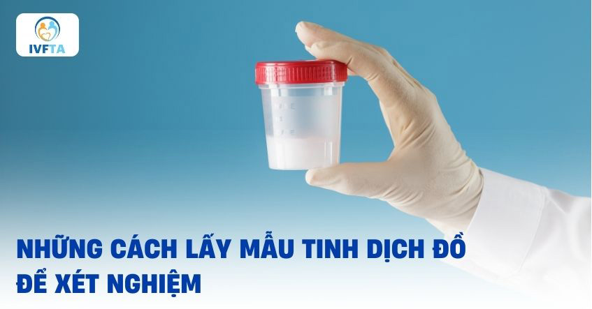 Cách lấy mẫu tinh dịch đồ Cách lấy mẫu tinh dịch đồ