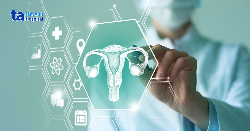 có thể gây vô sinh có thể gây vô sinh