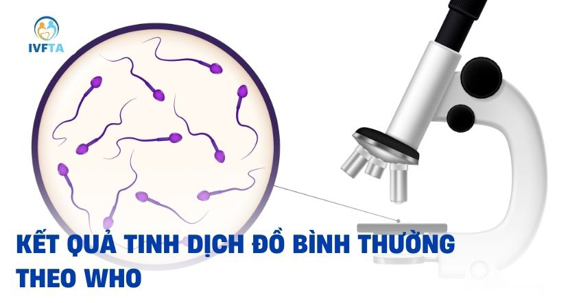 Kết quả chỉ số tinh dịch đồ bình thường