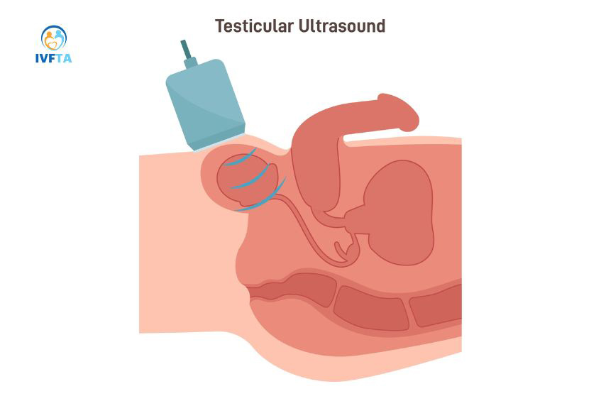 Siêu âm bìu cho phép kiểm tra cấu trúc bên trong để phát hiện các bất thường Siêu âm bìu cho phép kiểm tra cấu trúc bên trong để phát hiện các bất thường