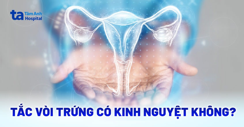 tắc vòi trứng có kinh nguyệt không tắc vòi trứng có kinh nguyệt không