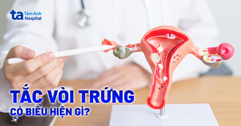 tắc vòi trứng tắc vòi trứng