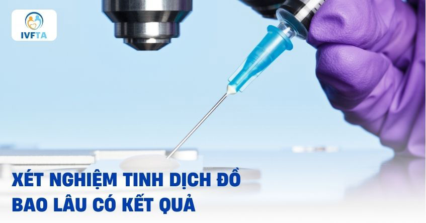 Xét nghiệm tinh dịch đồ bao lâu có kết quả? Xét nghiệm tinh dịch đồ bao lâu có kết quả?
