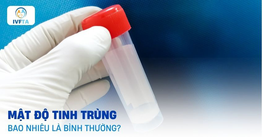 Mật độ tinh trùng bao nhiêu là bình thường? Mật độ tinh trùng bao nhiêu là bình thường?