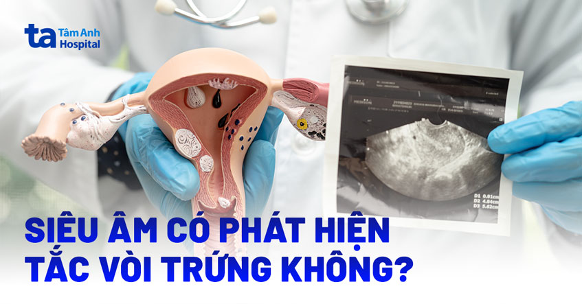 siêu âm có phát hiện tắc vòi trứng không siêu âm có phát hiện tắc vòi trứng không