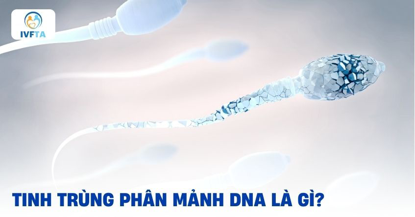 Tinh trùng phân mảnh DNA là gì? Tinh trùng phân mảnh DNA là gì?