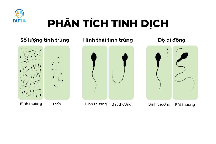 Những vấn đề bất thường ở tinh trùng có thể làm tăng nguy cơ vô sinh ở nam giới Những vấn đề bất thường ở tinh trùng có thể làm tăng nguy cơ vô sinh ở nam giới