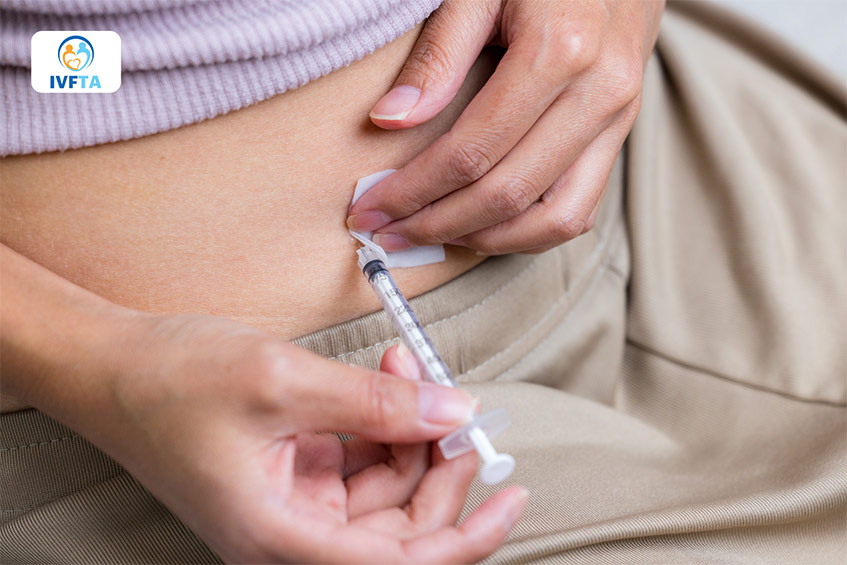 Quá trình kích trứng khi làm IVF sẽ kéo dài 10-12 ngày