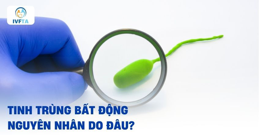 tinh trùng bất động không di chuyển