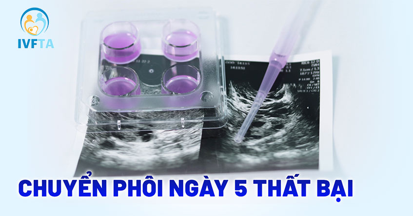 Tại sao chuyển phôi ngày 5 vẫn thất bại nhiều lần? Cần làm gì?