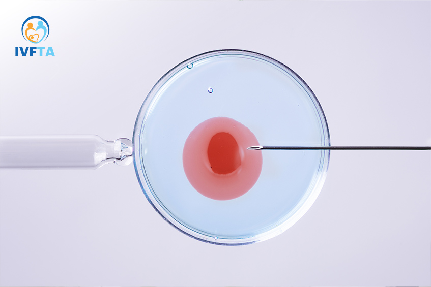 Mỗi người được hiến trứng bao nhiêu lần được quy định cụ thể nhằm đảm bảo an toàn cho cả người hiến và người nhận Mỗi người được hiến trứng bao nhiêu lần được quy định cụ thể nhằm đảm bảo an toàn cho cả người hiến và người nhận