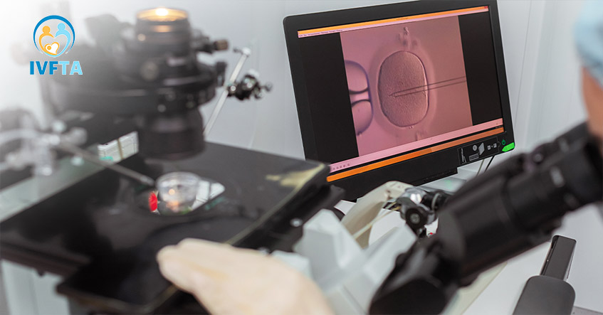 quy-trinh-chuyen-phoi-n3