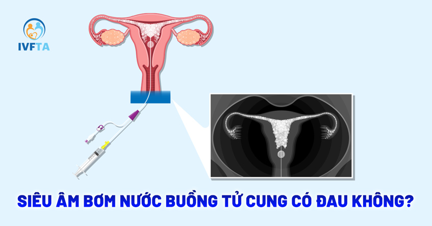 Siêu âm bơm nước buồng tử cung có đau không? [Bác sĩ giải đáp]