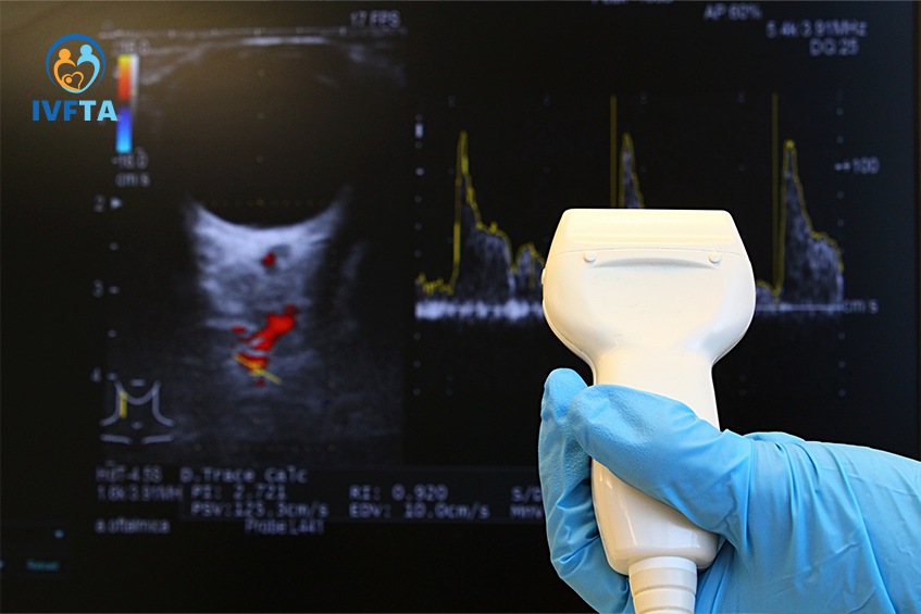 Siêu âm Doppler màu giúp hỗ trợ chẩn đoán các bệnh lý gây ảnh hưởng đến sức khỏe sinh sản nam giới