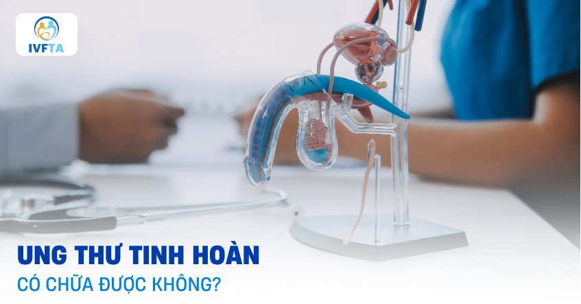 Ung thư tinh hoàn có chữa được không​?