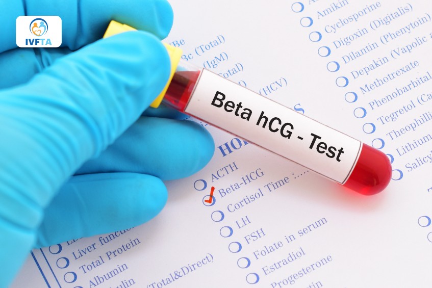 Giai đoạn ngày 11-13 sau chuyển phôi là thời điểm lý tưởng để thực hiện xét nghiệm beta hCG Giai đoạn ngày 11-13 sau chuyển phôi là thời điểm lý tưởng để thực hiện xét nghiệm beta hCG