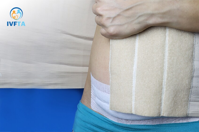 Phụ nữ sau sinh cần tham khảo ý kiến bác sĩ trước khi sử dụng nịt bụng để tránh nguy cơ sa tử cung