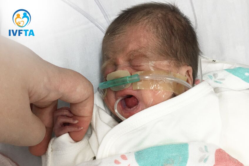 bé minh châu lúc mới sinh chỉ nặng 650g