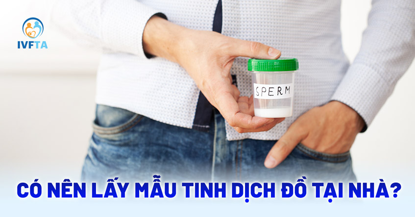 Có nên lấy mẫu tinh dịch đồ tại nhà? Có nên lấy mẫu tinh dịch đồ tại nhà?