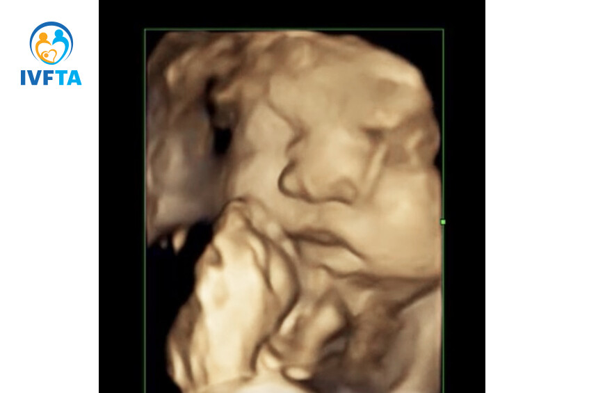 hình ảnh siêu âm của mẹ hoài thư hình ảnh siêu âm của mẹ hoài thư