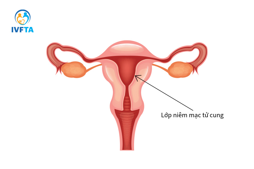 Lớp nội mạc tử cung là lớp bao phủ bên trong tử cung