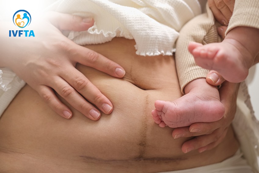 Đây là tình trạng hiếm gặp nhưng đang có xu hướng gia tăng do sự gia tăng tỷ lệ sinh mổ