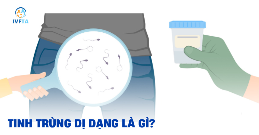 Tinh trùng dị dạng là gì?