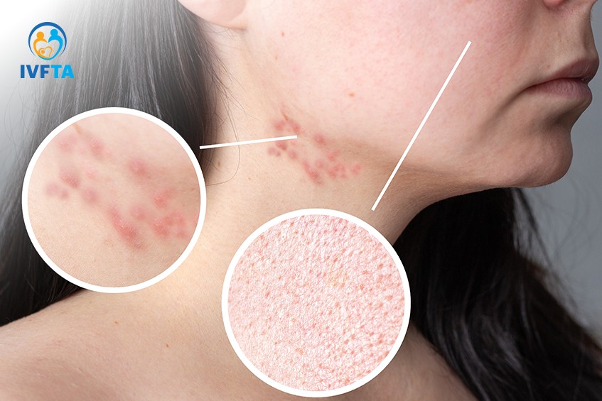 Các thay đổi nội tiết và dấu hiệu cơ thể có thể ảnh hưởng đến khả năng thụ thai