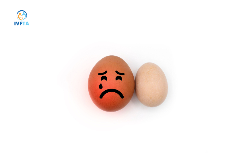 Tinh hoàn trái bị đau thường liên quan đến nguyên nhân giãn tĩnh mạch thừng tinh, xoắn tinh hoàn…