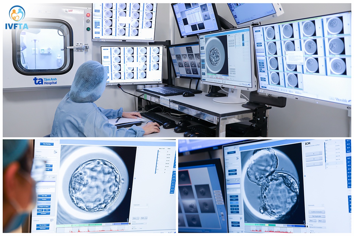 ivf tâm anh ứng dụng ai theo dõi phát triển phôi