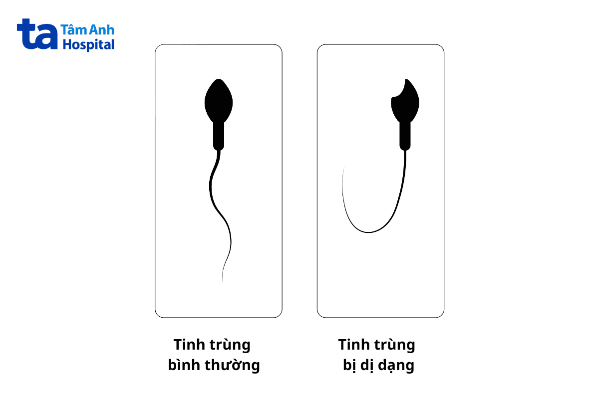 chất lượng tinh trùng ảnh hưởng quá trình tạo phôi