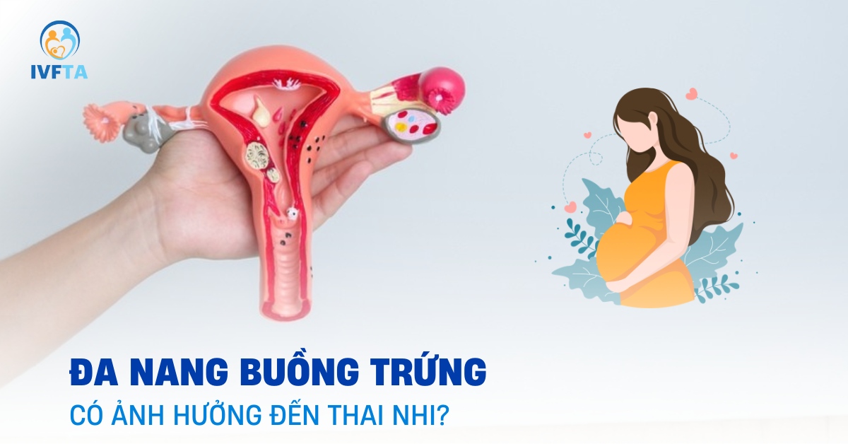 đa nang buồng trứng có ảnh hưởng đến thai nhi đa nang buồng trứng có ảnh hưởng đến thai nhi