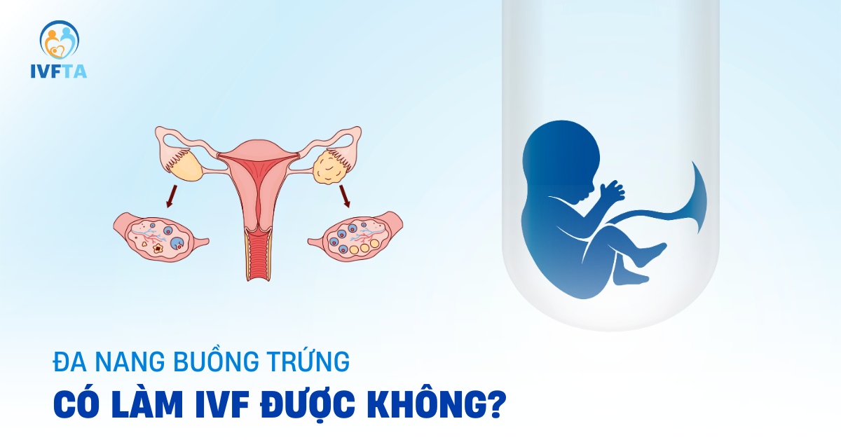 đa nang buồng trứng có làm ivf được không đa nang buồng trứng có làm ivf được không