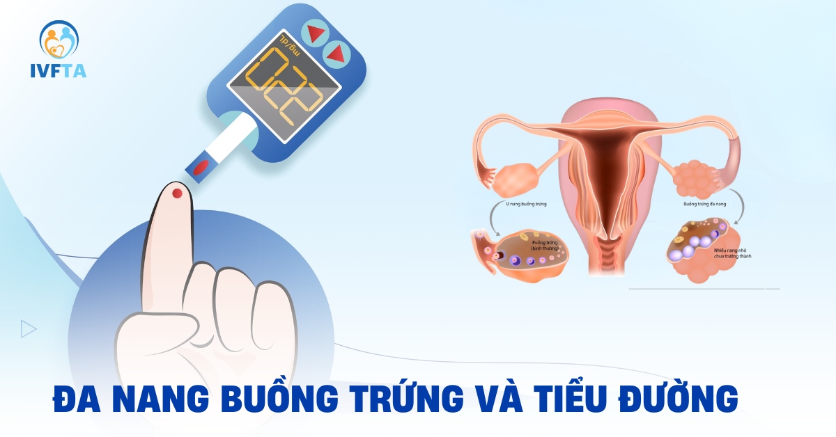 đa nang buồng trứng và tiểu đường