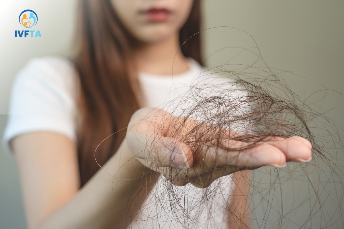 rụng tóc là biểu hiện thường gặp của pcos
