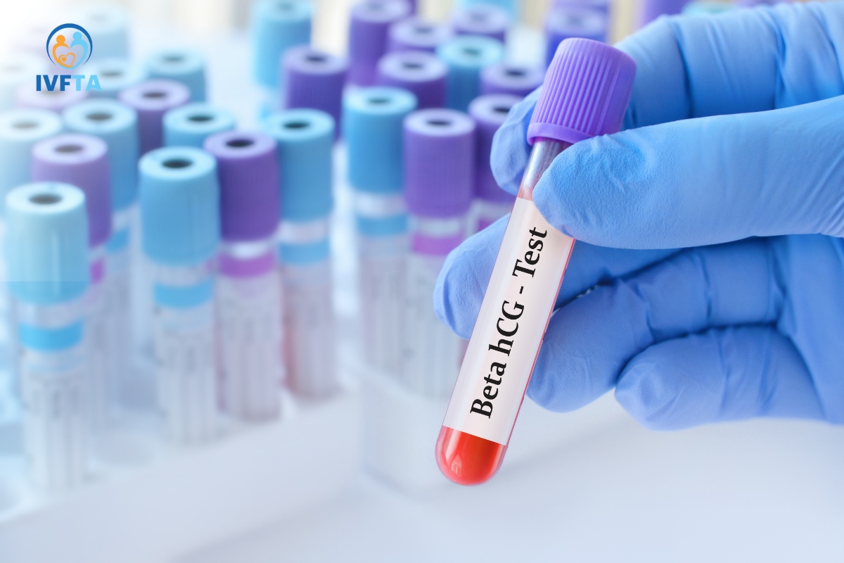 beta hcg quyết định thời điểm chuyển phôi phù hợp beta hcg quyết định thời điểm chuyển phôi phù hợp